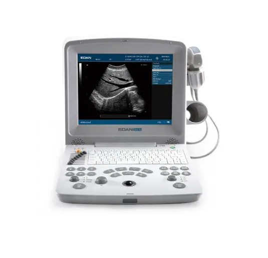 Echographe Photo d'un matériel médical connecté : échographe
